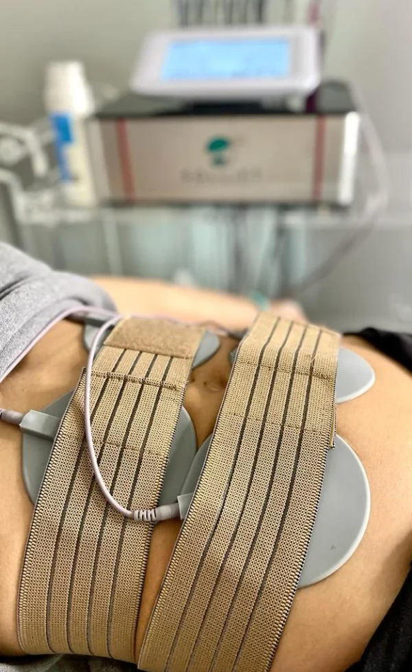Fit Moderna EMS and Vacuum Cupping Therapy - Image 5