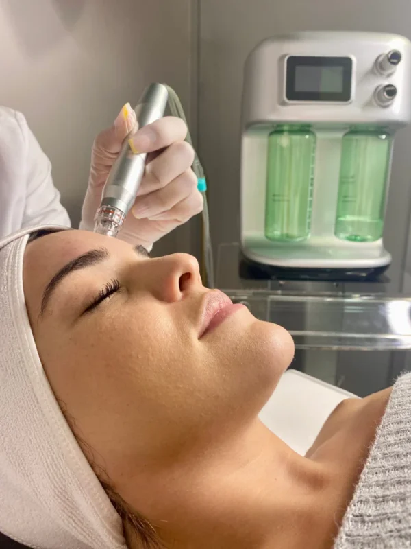 Tru Hydro 2-in-1 Hydrodermabrasion and Microdermabrasion - Image 6