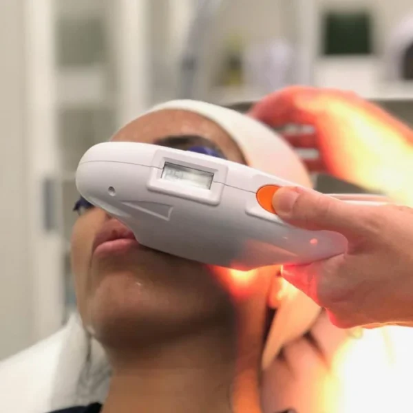 The Medi Next Advanced IPL Hair Removal and Skin Rejuvenation - Image 3