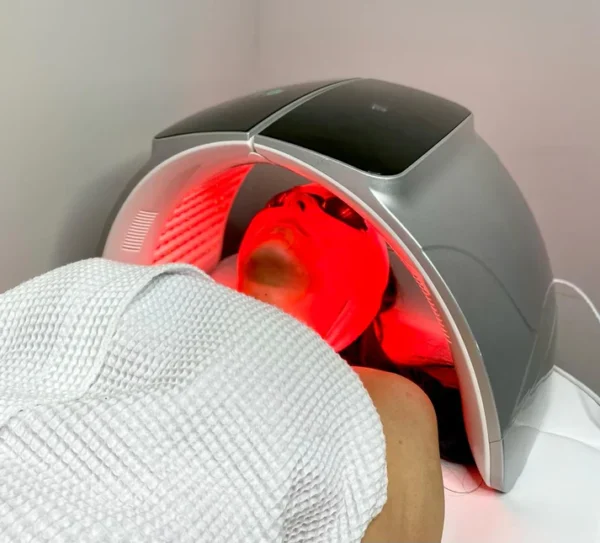 Spark LED Light Therapy - Image 7