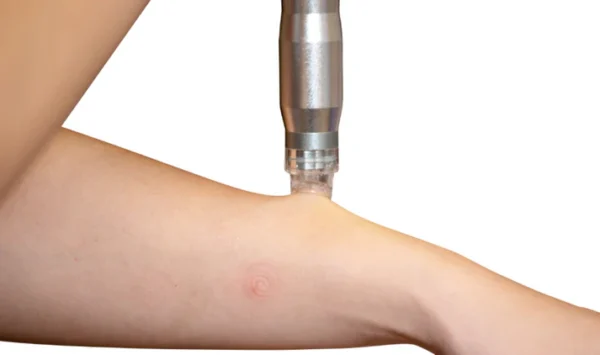 Tru Hydro 2-in-1 Hydrodermabrasion and Microdermabrasion - Image 3