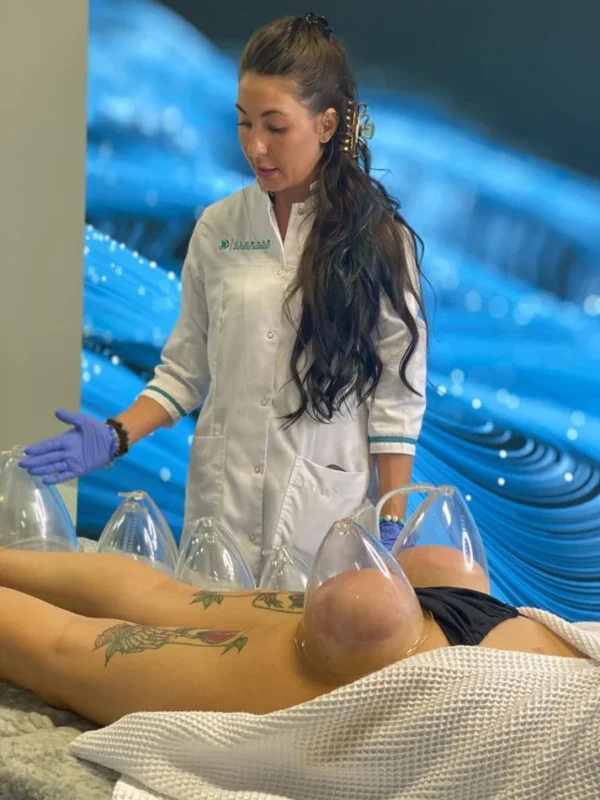 Curv Vacuum and Cupping Therapy - Image 4
