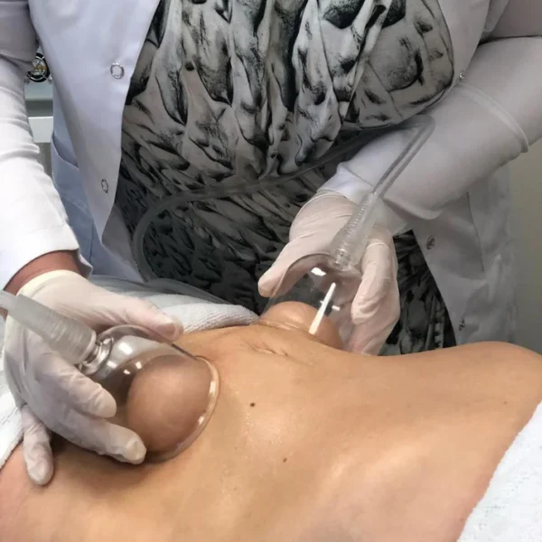 Curv Vacuum and Cupping Therapy - Image 7