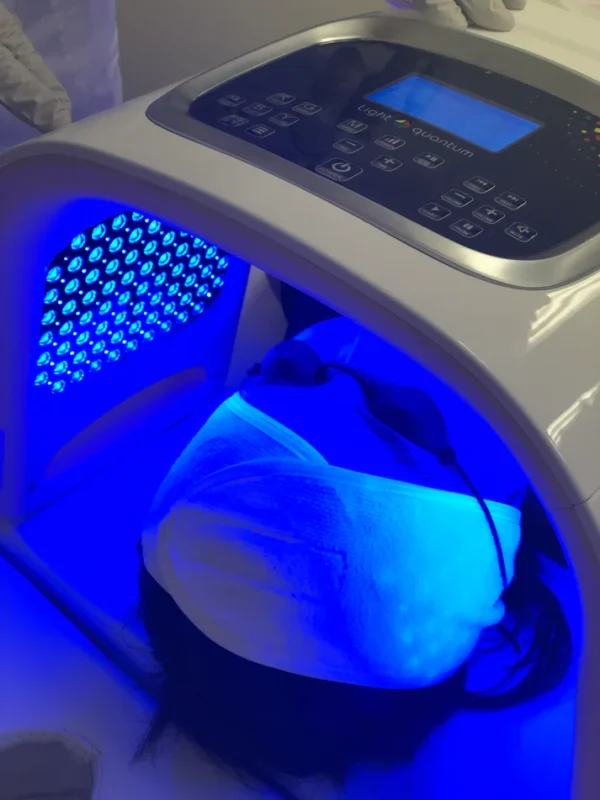 Pro Light Therapy and Microcurrent - Image 2
